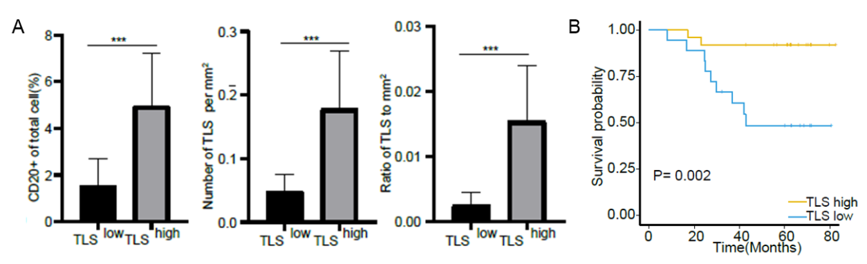 图5 早期肺腺癌中TLS与预后结果呈正相关.png